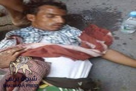 سقوط جرحى في ساحة العروض وجولة الثقافة جراء رصاص الأمن اليمني