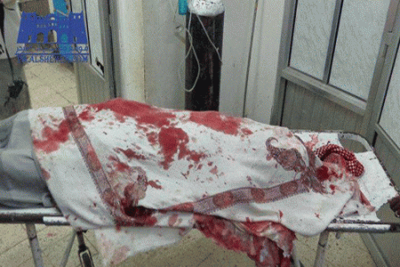 نجاة مدير البحث الجنائي بالشحر من محاولة اغتيال