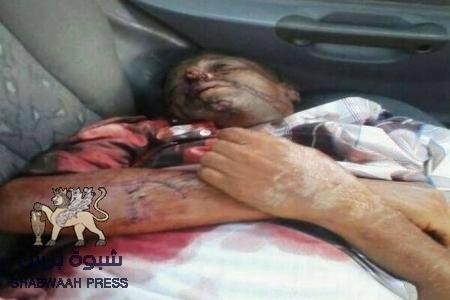 عاجل : مقتل مواطن حضرمي برصاص طقم عسكري على مدخل مدينة الشحر الغربي