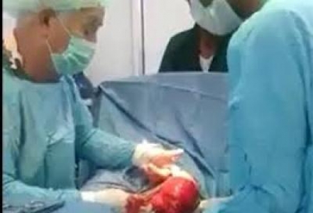 مصادر تكشف عن عملية فساد في مستشفى الريدة الشرقية والسلطة لم تتخذ إي إجراء إزاء القضية‎