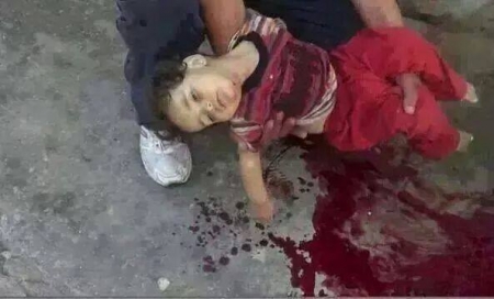 عديمي الاخلاق في صنعاء ... ازمة اخلاق أم شركاء في مجزرة الضالع
