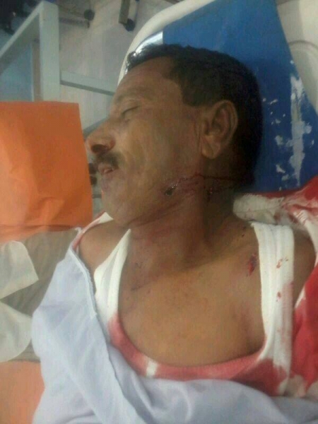 قتيل وجريح برصاص مسلحين في مدينة الشحر بحضرموت