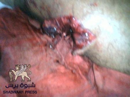 تفاصيل قصف الجيش والحرس الجمهوري اليمني الضالع اليوم اول ايام (عيد الفطر المبارك  ) صور