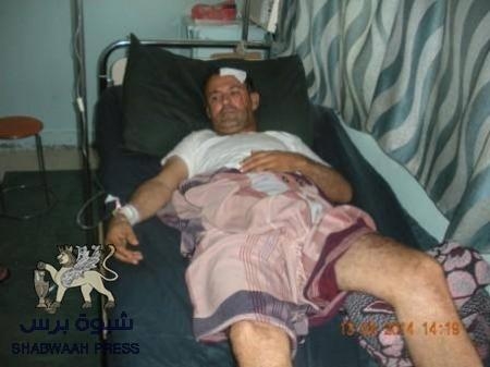 تعرض مدير أمن تبن محمد فريد لأصابه بليغة في انفجار عبوة ناسفة في صبر.