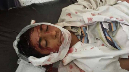 11 قتيل بانفجارات عمران وغارة تقتل 5 من قيادات ‘‘القاعدة‘‘ في شبوه