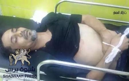 معلومات جديدة عن استشهاد  القيادي في الثورة الجنوبية م.خالد الجنيدي على يد قوات الاحتلال اليمني في كريتر عدن