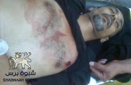 توثيق رقم الطقم العسكري الذي قتل جنوده الشهيد الجنيدي
