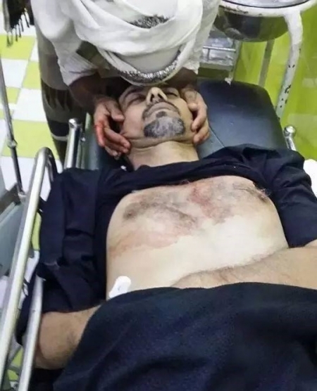 سكاي نيوز : مقتل قيادي بالحراك الجنوبي في عدن