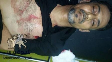 منظمة حقوقية : قوات الامن اليمنية تعمدت تصفية القيادي بالحراك خالد الجنيدي