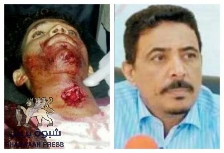 دم الشهيد ‘‘مطلوب‘‘ في رقبة أحمد علي باحاج ( صور جديدة )