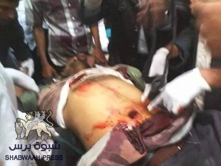 عاجل : إستشهاد شابين من أبناء شبوه برصاص الأمن المركزي