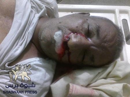 ‘‘ شبوه برس‘‘ ينشر تقرير الطبيب الشرعي يزيد عطروش عن وفاد الشهيد اليزيدي (وثيقة وصور)