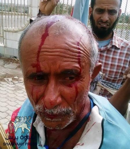 أول دماء لمسن جنوبي في عهد حبتور: إعتداء الامن المركزي على محتجين امام استاد 22 ما يوم الشيخ عثمان بعدن