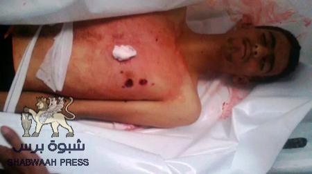 اسبوع الموت في الضالع : من يوقف جنون المحتلون بقتل شباب  الضالع والجنوب