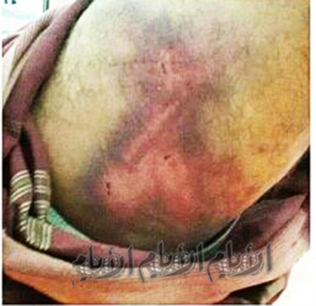 بن شحبل يكشف لـ ‘‘ الأيام‘‘ صنوف التعذيب في زنازين الاعتقال