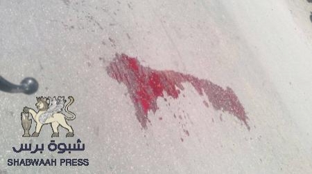 مواطن حضرمي يفشل عملية اغتيال مسئول أمني والقبض على الجناة (صور)