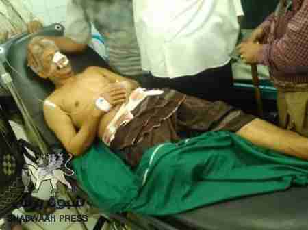 عاجل : نجاة المناضل بجاش الأغبري من محاول اغتيال آثمة (صور)