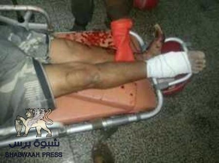 سقوط 3 جرحى اثر اقتحام جيش صنعاء لردفان وقصف عنيف لكافة القرى