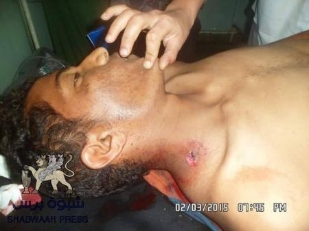 مقتل شخص من تعز جراء تجدد القصف على اﻟﻀﺎﻟﻊ (صور)