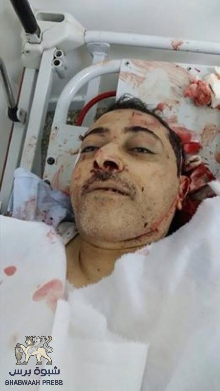 اغتيال الصحفي اليمني عبدالكريم الخيواني