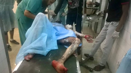 عشرات الجثث للقتلى ومئات الجرحى جراء انفجار جبل حديد