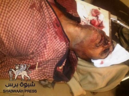 عاجل: معارك ضارية على مشارف العند واستشهاد مقاوم هثيم الحالمي