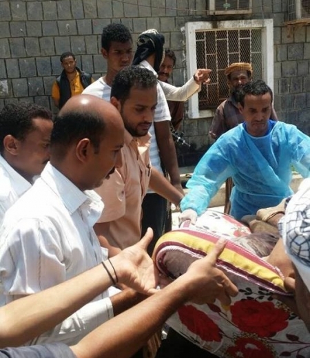 جريحين في مواجهات بين مواطنين ومجموعة من تحالف عفاش الحوثي