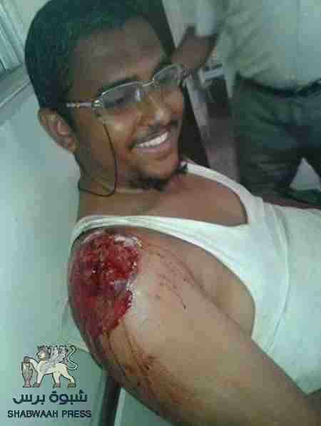 أبناء عدن يستشهدون أبطالآ ... ويبتسمون رغم الجراح