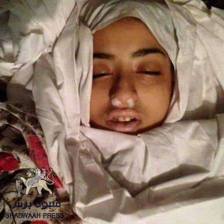 استشهاد فتاة عشرينية في عدن برصاص قناص حوثي