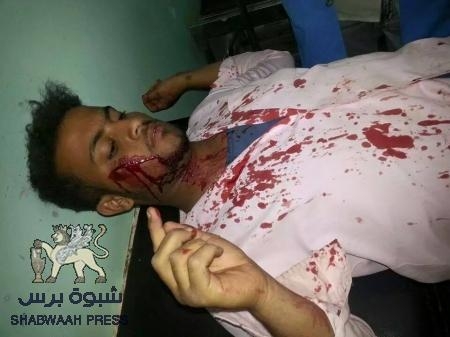 ثلاثة شهداء من أبطال المقاومة الجنوبية في خورمكس وعدد من الجرحى