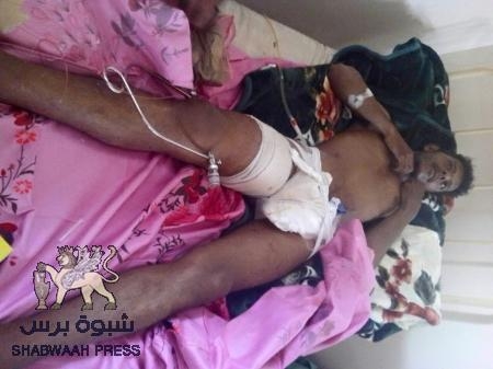 محمد الزبير .. زعيم الإنسانية جريحا في ميدان الشرف