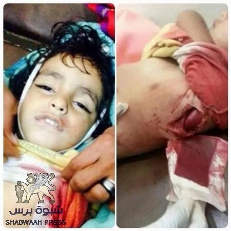 شهيدان احدهم طفل بطلقة قناص بالرأس اثناء قيام مواقع مليشيات الحوثي بقصف مناطق الضالع