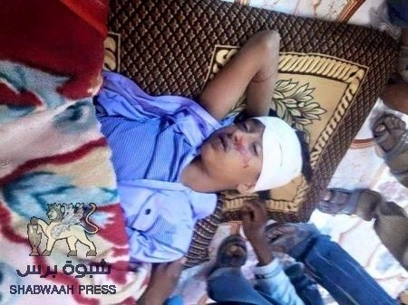 مـيليشيات الحوثي وصالح ترتكب مجازر في خور مكسر