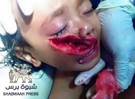 حرب المخلوع والحوثيين على تحصد أرواح الأطفال الأبرياء الى جانب الآباء