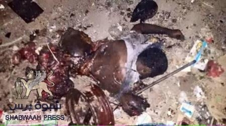 عشرات من القتلى والجرحى في مذبحة قوات الاحتلال اليمني لمنصورة عدن (صور بشعة)