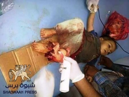 في آخر إحصائية:31 شهيدا و103جريحا من النساء والأطفال النازحين من منازلهم في عدن (صور)