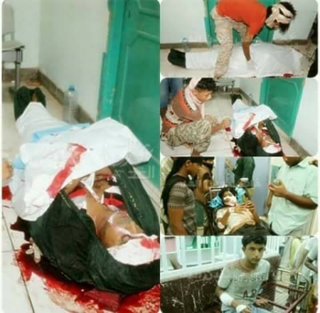 مركز مدار للدراسات والبحوث يدين الجرائم  المشينة التي تقوم بها مليشيات الحوثيين وصالح.