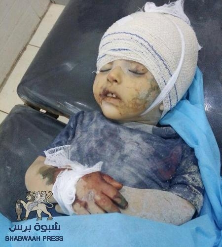 18 شهيد و117 جريح ضحايا مجزرة 7-7 للحوثيين بمنصورة عدن (صور)