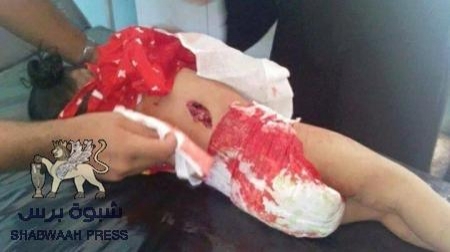 منظمة حقوقية : تتهم ميليشيا الحوثي وصالح بارتكاب جرائم حرب ضد المدنيين في عدن
