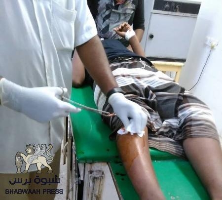 الرصاص الطائش يلاحق أسرة المواطن بامهري والعناية الإلهية تنقذهم من موت محقق