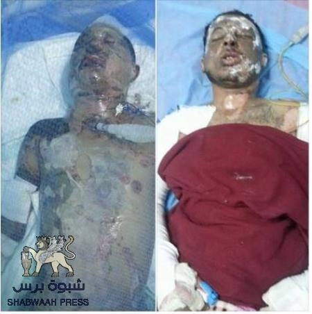 للجرحى، جراحات مفتوحة على الوجع ... يا بحاح !!