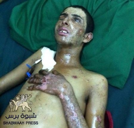 الى ‘‘بحاح‘‘ و ‘‘راجح بادي‘‘ .. إنقذوا هذا الجريح ودعوا أعلام الجنوب