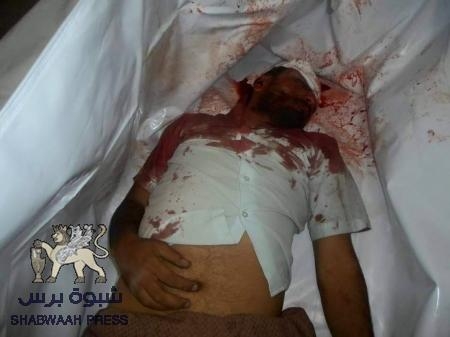 مسئول رصد وتوثيق شهداء وجرحى مقاومة العند رصدنا ووثقنا 199 شهيد 763جريحا
