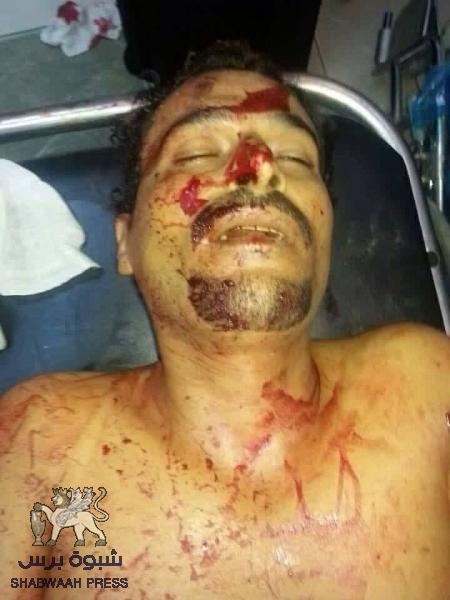 مقتل مواطن في المنصور على أيدي مسلحين مجهولين