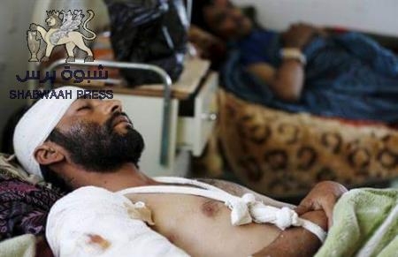 الى وزير الصحة اليمني باعوم الخليفي : صرخات جرحى ‘‘الاردن‘‘ هل تسمعها !!