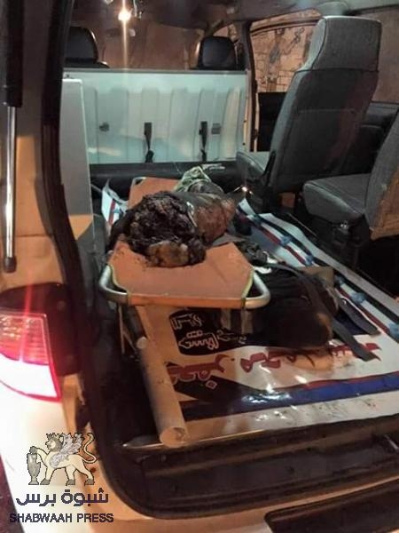 6شهداء و9جرحى من افراد نقطة العقبة بينهم مواطنين في عملية التفجير الإرهابية (صور)