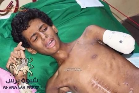 العوادي ينقض إتفاقا عقده شلال مع بحاح لصالح علاج جرحى المقاومة