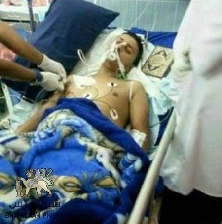 في حضور حكومة بحاح للسفر والسياحة : وفاة الجريح أيمن إقبال