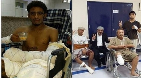 مهندس ألغام جنوبي يصر على مواصلة عملة بعد أن بترت قدمه