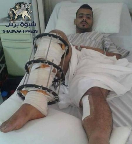 لعدم إستفادته من العلاج في الأردن : جريح جنوبي يناشد الرئيس هادي إعادته الى موطنه عدن